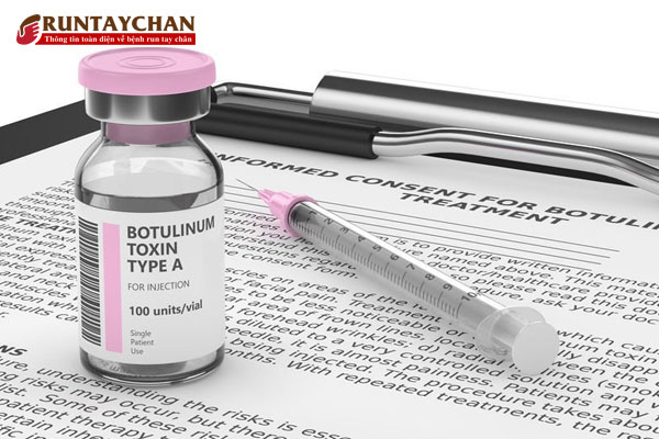 BotuIinum Toxin (Bo-tox)
